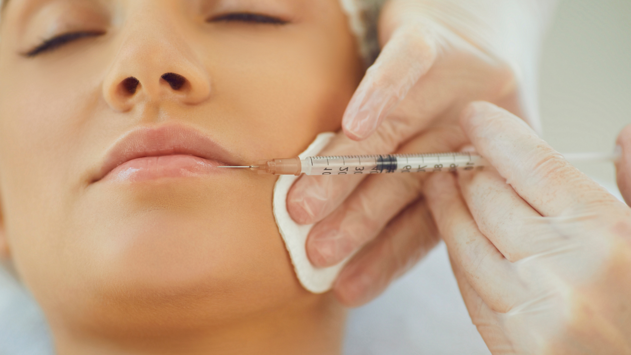 A Model receiving a lip filler injection by a trained practitioner.