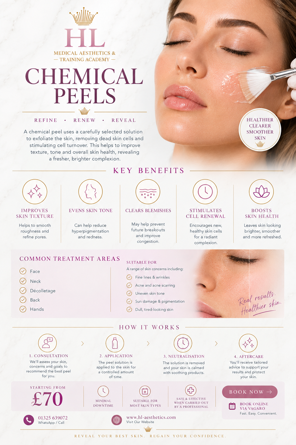 An informational flyer for 'HL Medical Aesthetics & Training Academy' Chemical Peels, featuring a close-up of a woman's face with skincare cream on her cheek, a gold crown logo, and various benefit and pricing details in a pink and white color scheme.
