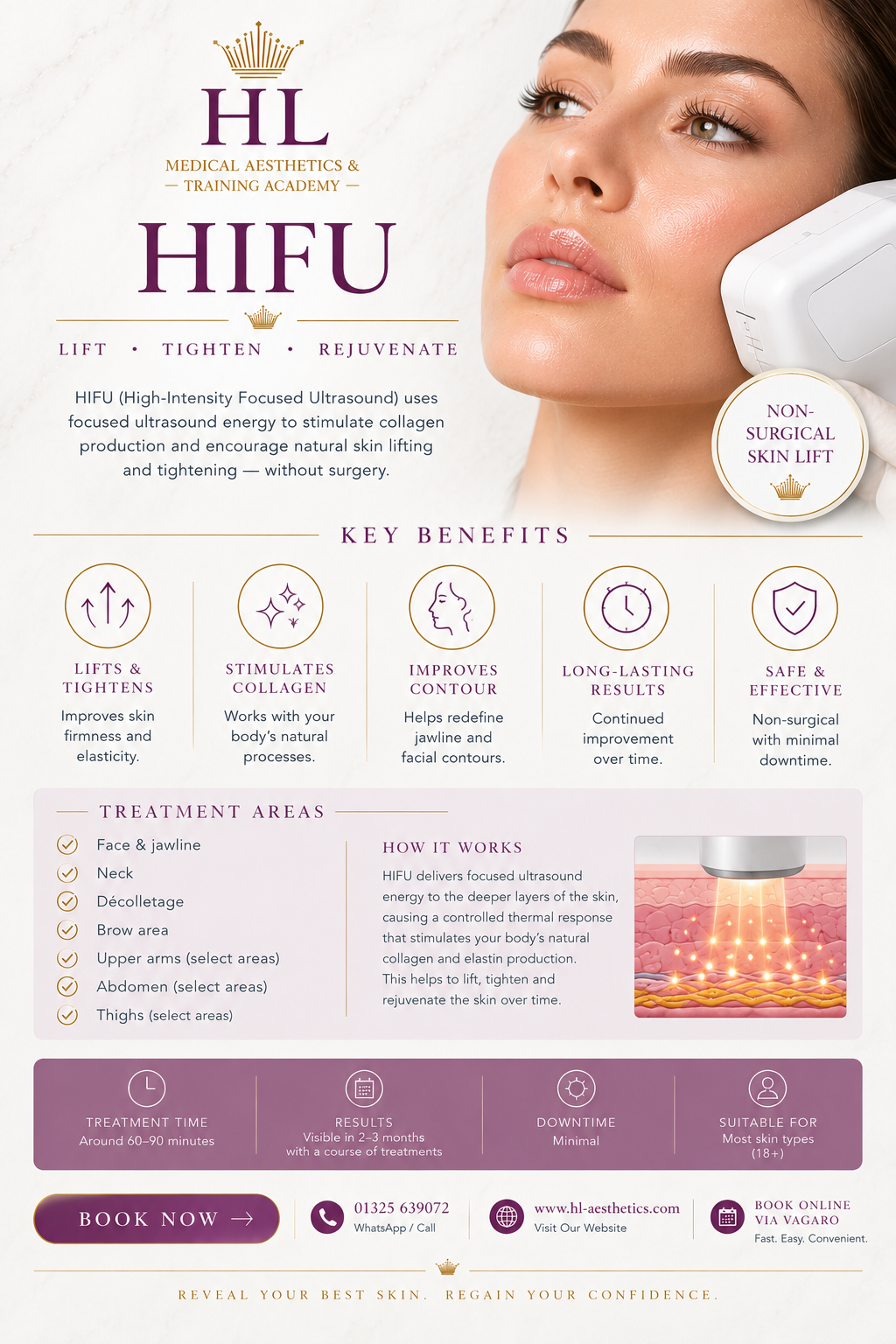 An informational flyer for 'HL Medical Aesthetics - Hifu' facial skin lifting treatment. The flyer features a close-up of a woman's face on the top right, showing the white handheld device being applied to her cheek.